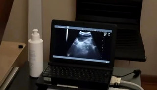 Gay sex ultra sound austin & dr wolf