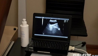anal sex ultrasound - 😍