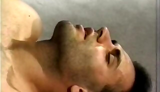 Hairline