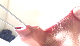 Friday Foreskin Compilation - 1 Of 2