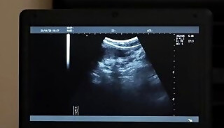 Horny doctor wolf anal fuck his petite gay patient