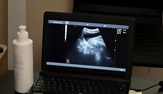 Petite twink bareback drilled at doctor office by hunk